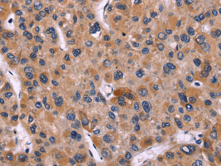 CARD11 Polyclonal Antibody Store at -20°C