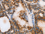 MUC6 Polyclonal Antibody