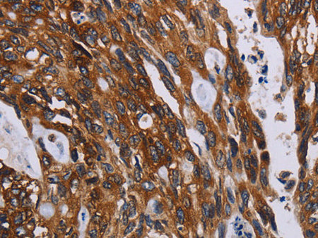 KARS Polyclonal Antibody Store at -20°C