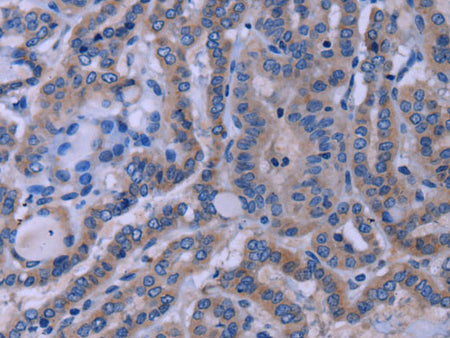 TUBGCP2 Polyclonal Antibody Store at -20°C