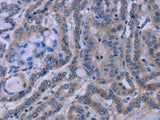 TUBGCP2 Polyclonal Antibody Store at -20°C