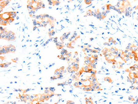 CCDC88A Polyclonal Antibody Store at -20°C