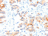 CCDC88A Polyclonal Antibody Store at -20°C