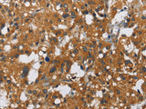 CARD9 Polyclonal Antibody Store at -20°C