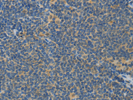 ASPA Polyclonal Antibody Store at -20°C