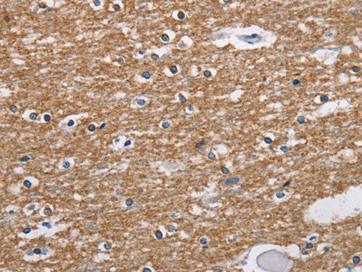 NCR2 Polyclonal Antibody Store at -20°C