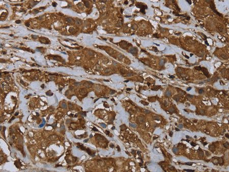 ARHGDIA Polyclonal Antibody Store at -20°C