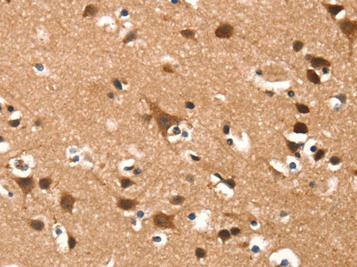 DAAM1 Polyclonal Antibody Store at -20°C