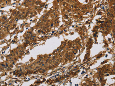 IL17RB Polyclonal Antibody Store at -20°C