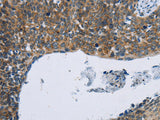 KPNB1 Polyclonal Antibody