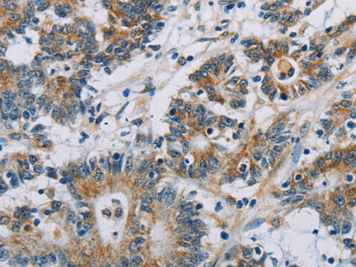 CSNK1E Polyclonal Antibody Store at -20°C