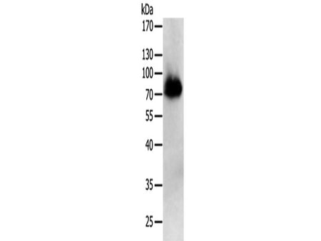 PRMT7 Polyclonal Antibody Store at -20°C