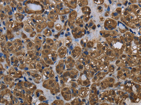 GSTP1 Polyclonal Antibody Store at -20°C