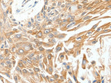 SCN11A Polyclonal Antibody Store at -20°C