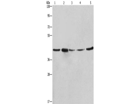 RPSA Polyclonal Antibody Store at -20°C