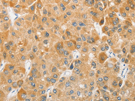 ATG5 Polyclonal Antibody Store at -20°C