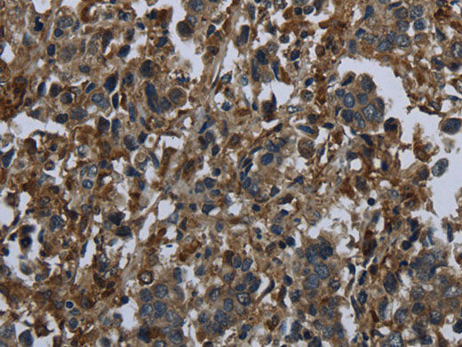 GLUL Polyclonal Antibody Store at -20°C