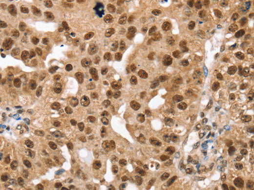 SMARCB1 Polyclonal Antibody Store at -20°C