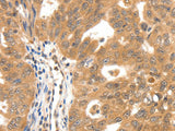 SCN5A Polyclonal Antibody