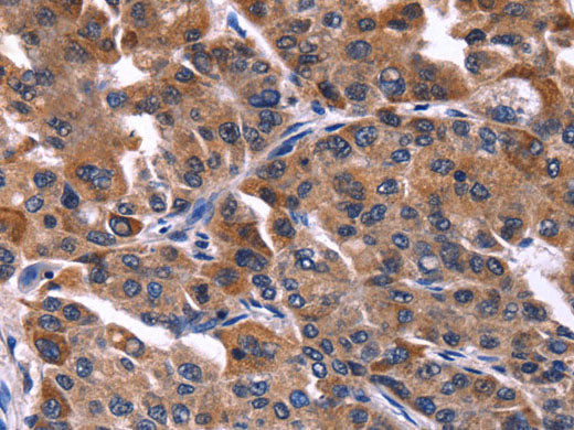 NFATC3 Polyclonal Antibody Store at -20°C