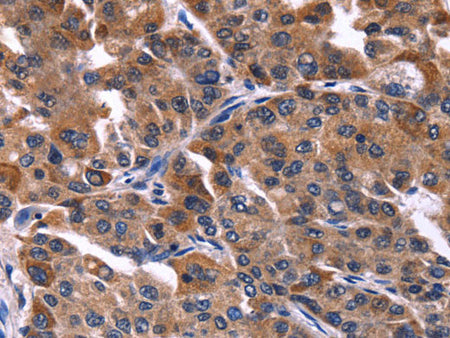 NFATC3 Polyclonal Antibody Store at -20°C