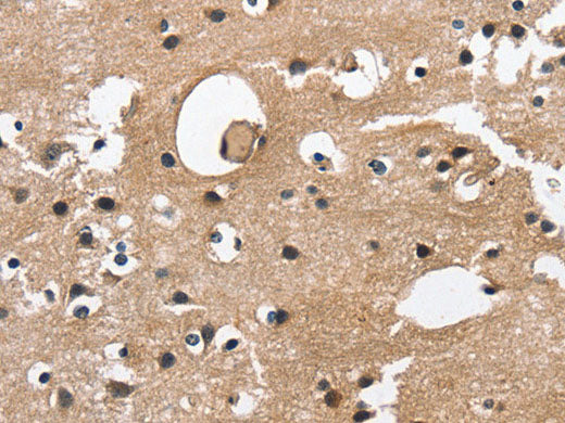 CAMK1D Polyclonal Antibody Store at -20°C