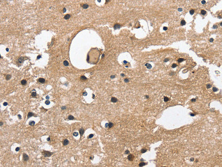 CAMK1D Polyclonal Antibody Store at -20°C