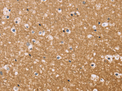 BGLAP Polyclonal Antibody Reactivity Human