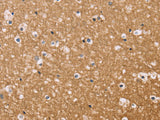 BGLAP Polyclonal Antibody Reactivity Human