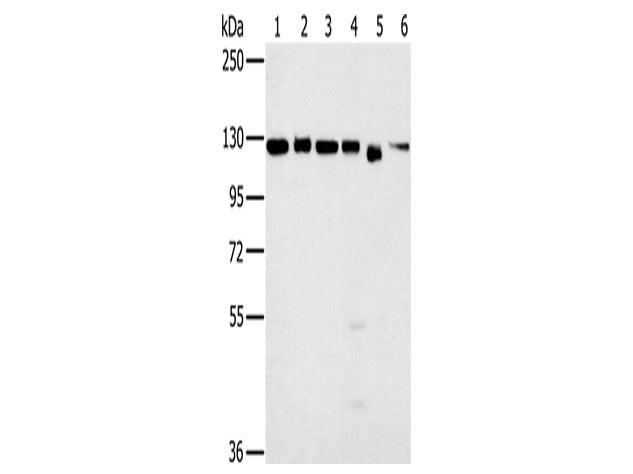 MATR3 Polyclonal Antibody Store at -20°C
