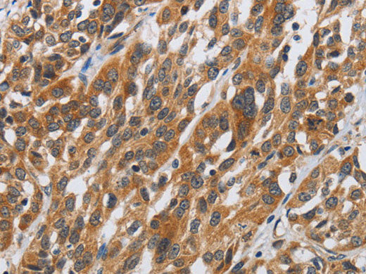 DSP Polyclonal Antibody Store at -20°C
