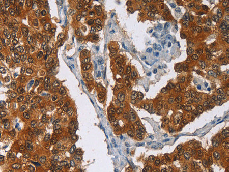 CRABP2 Polyclonal Antibody Store at -20°C