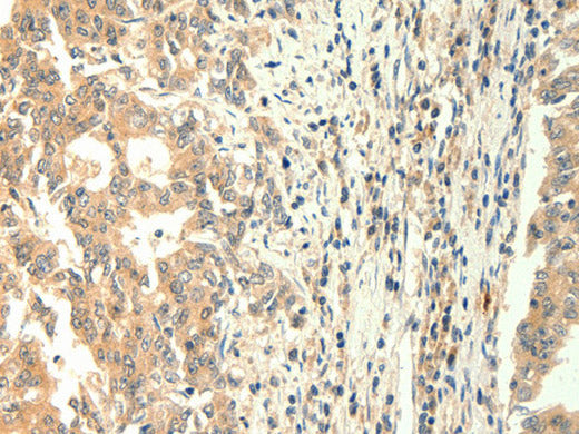 TRPM5 Polyclonal Antibody Store at -20°C