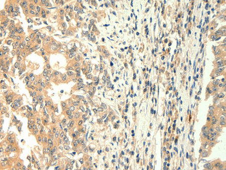 TRPM5 Polyclonal Antibody Store at -20°C