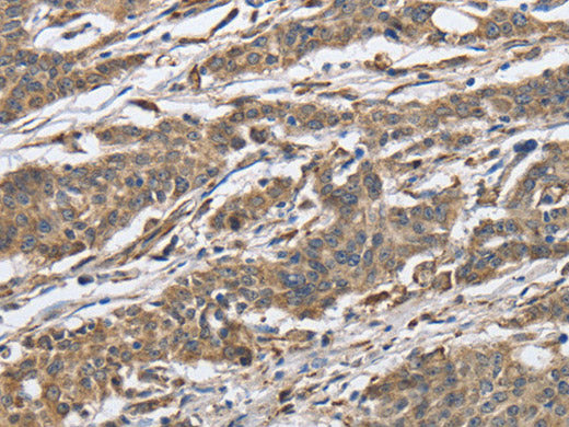 IPO7 Polyclonal Antibody Store at -20°C