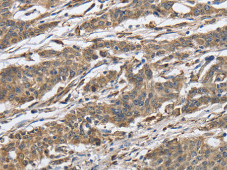 IPO7 Polyclonal Antibody Store at -20°C