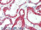 HSD17B8 Polyclonal Antibody Store at -20°C