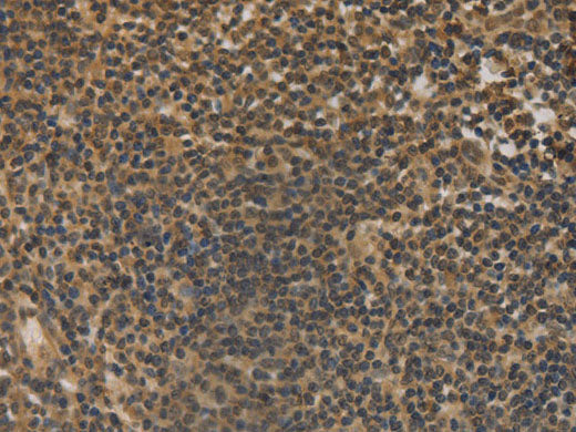 DACH1 Polyclonal Antibody Store at -20°C