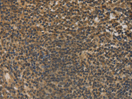 DACH1 Polyclonal Antibody Store at -20°C