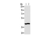 NDUFA10 Polyclonal Antibody Store at -20°C