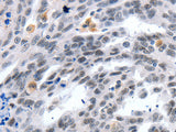 LRP5 Polyclonal Antibody Store at -20°C