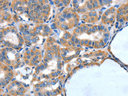 XBP1 Polyclonal Antibody Store at -20°C
