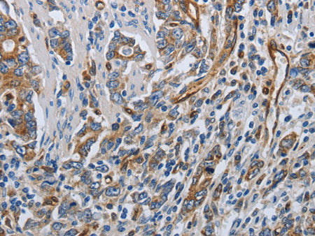 SOCS1 Polyclonal Antibody Store at -20°C