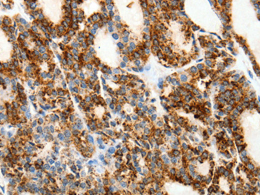 SSTR1 Polyclonal Antibody Store at -20°C