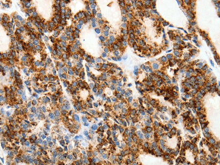 SSTR1 Polyclonal Antibody Store at -20°C