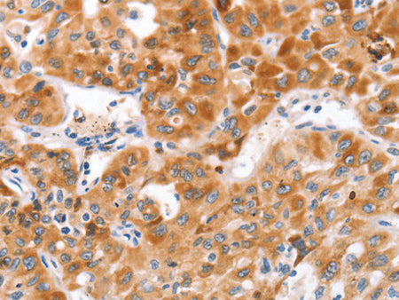 NOD1 Polyclonal Antibody Store at -20°C