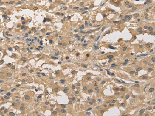 ALDH8A1 Polyclonal Antibody Store at -20°C