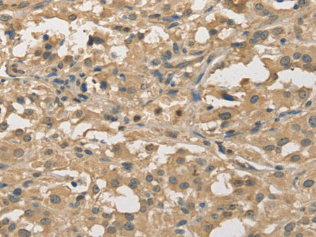 ALDH8A1 Polyclonal Antibody Store at -20°C