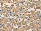 ALDH8A1 Polyclonal Antibody Store at -20°C