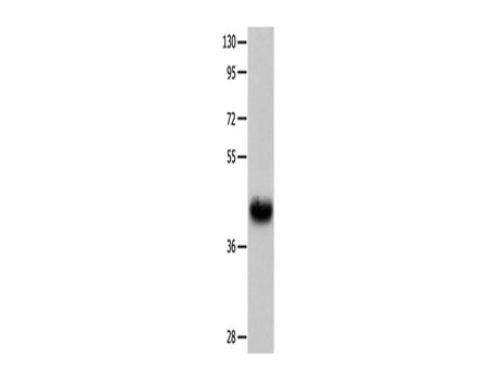 UTS2R Polyclonal Antibody Store at -20°C